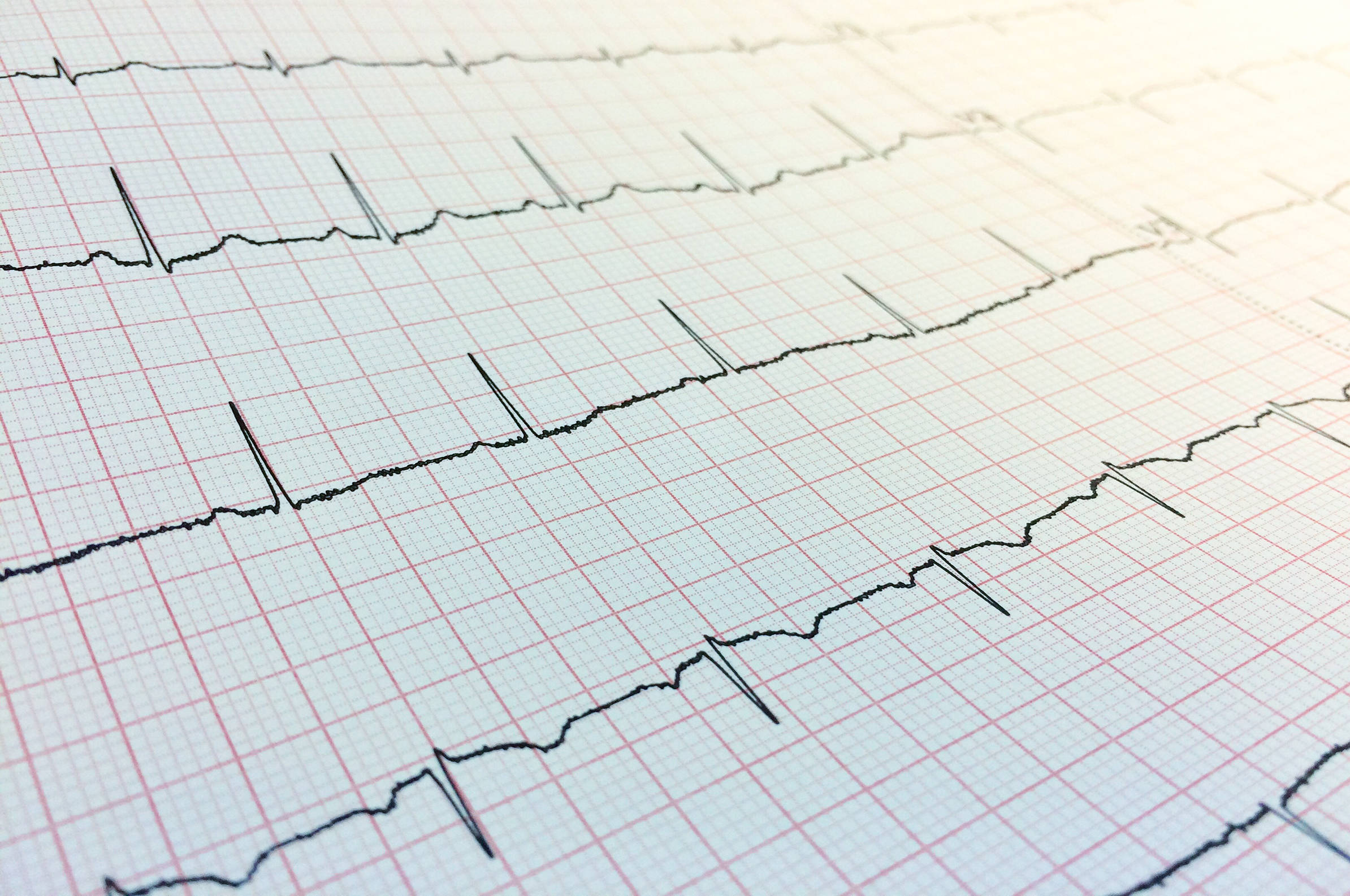 Herzfrequenz VNS-Analyse - Königshof Health & View Oberstaufen - Offizielle Webseite